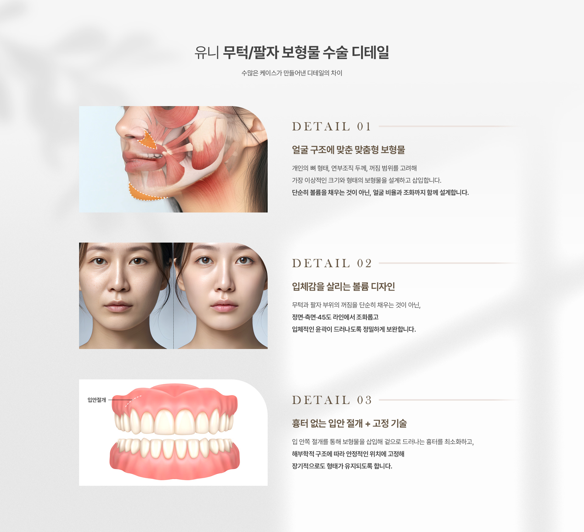 무턱/팔자보형물 04