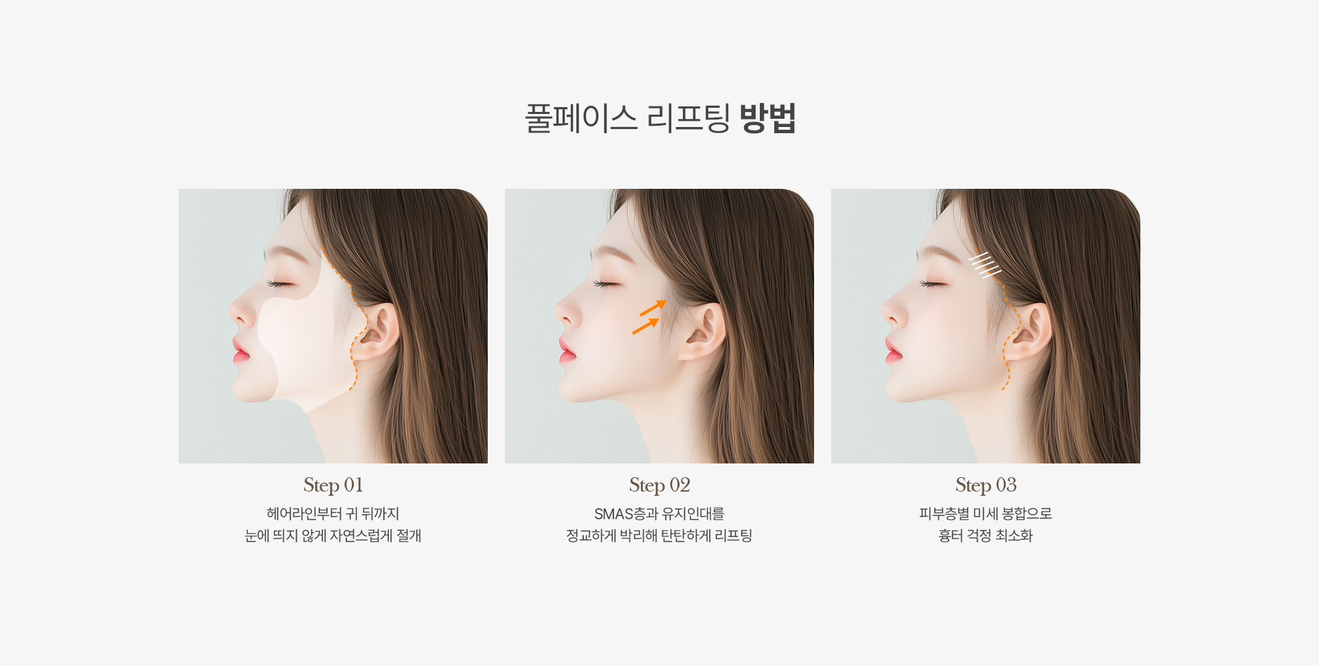 풀페이스리프팅 03