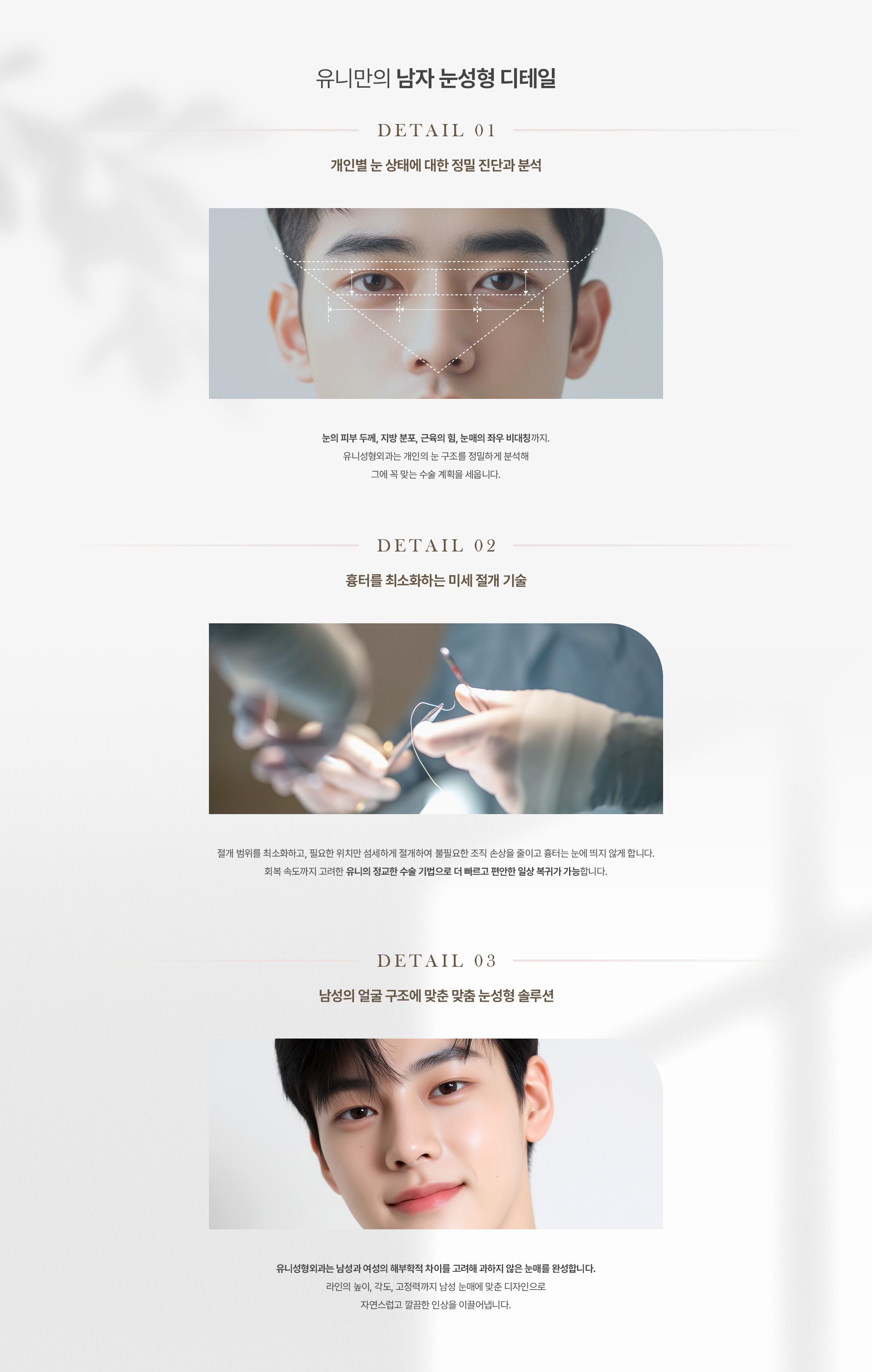 남자눈성형 04