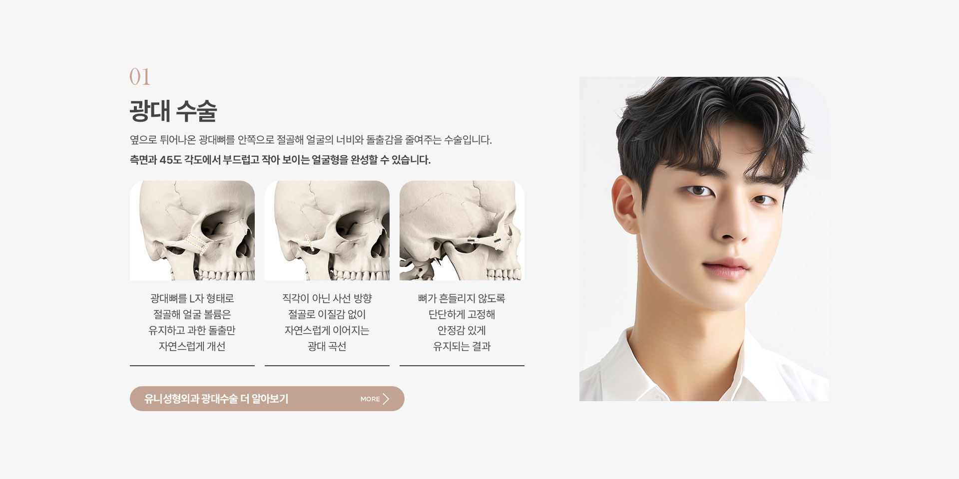 남자안면윤곽 03