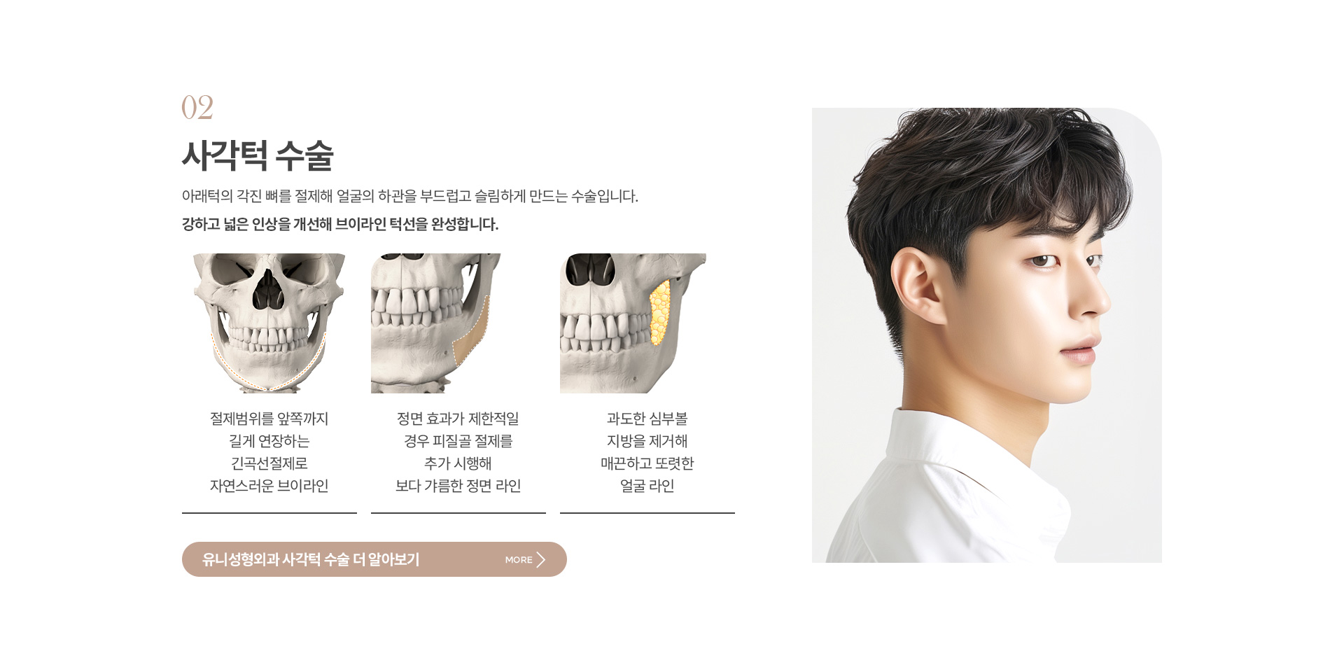 남자안면윤곽 04