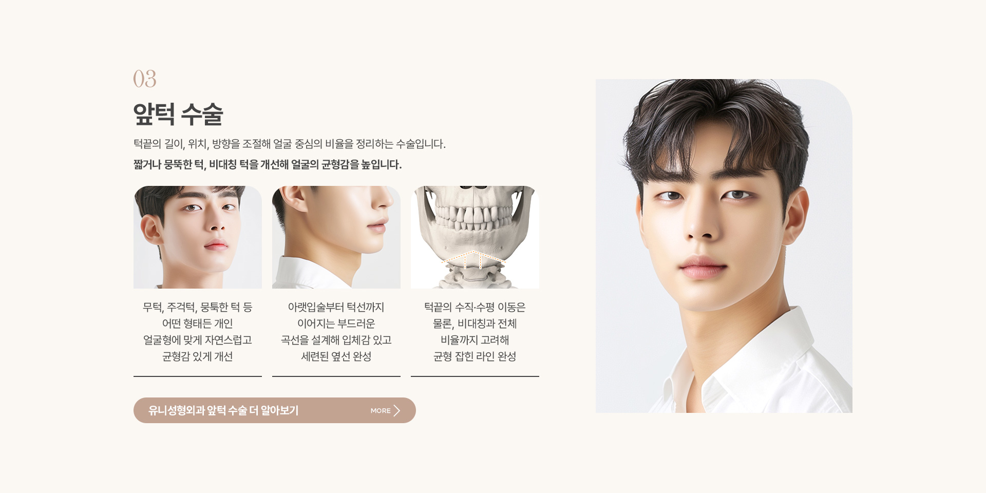 남자안면윤곽 05