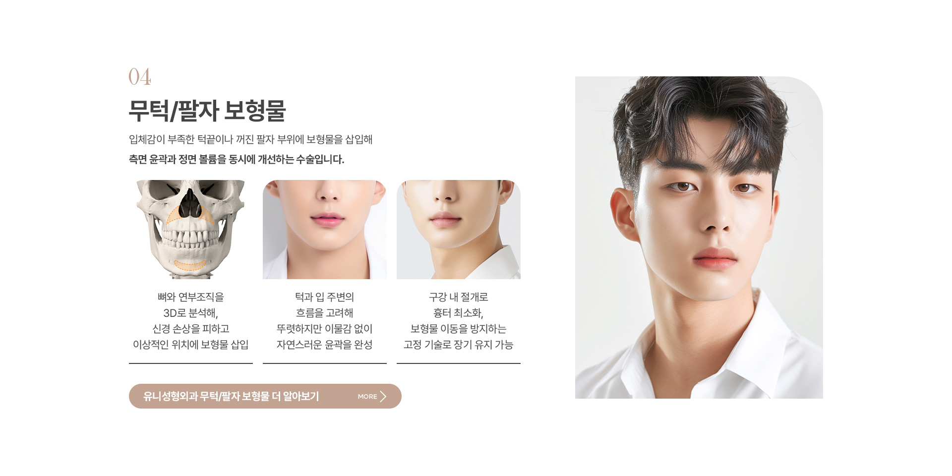 남자안면윤곽 06