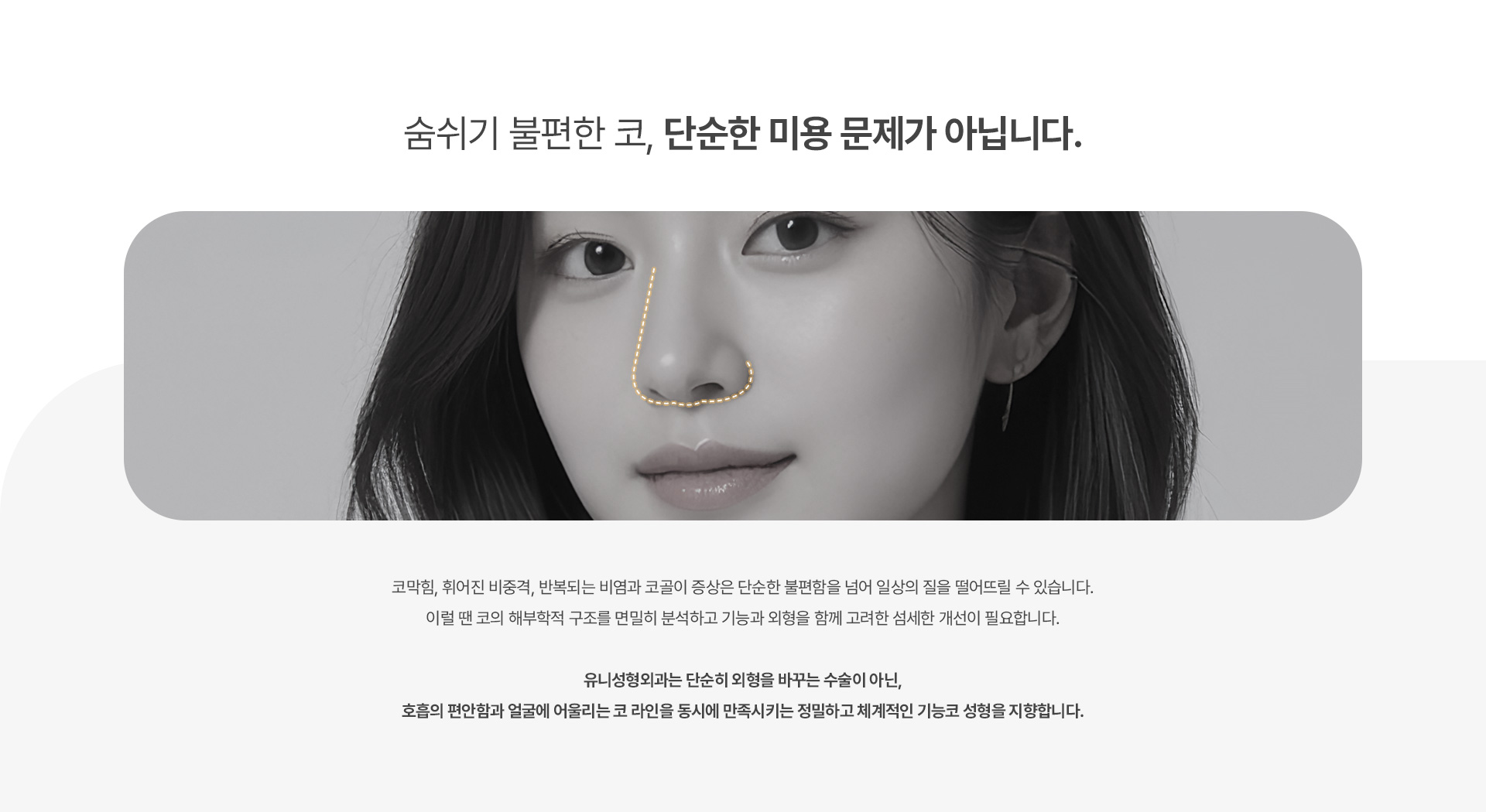 기능코성형 02